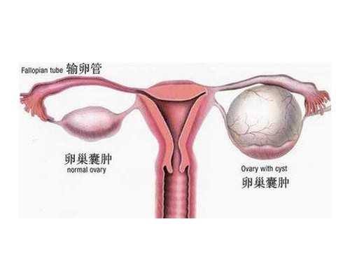 在新疆军区总医院做试管婴儿要花多少钱