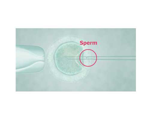 在新疆军区总医院做试管婴儿,生男孩的几率有多大?