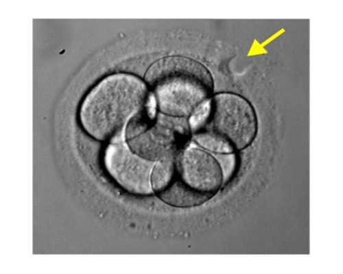广州助孕公司怎么选？这些优势值得了解