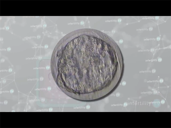 上海供卵试管机构怎么选?5大核心指标帮你避开“隐形坑”