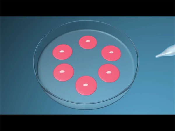子宫环境决定成败！试管婴儿移植双胎前的必备检查清单